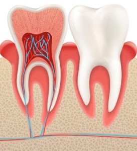 Root Canal In 77504