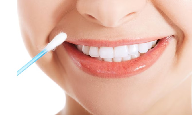 Tooth Whitening Near Westwood